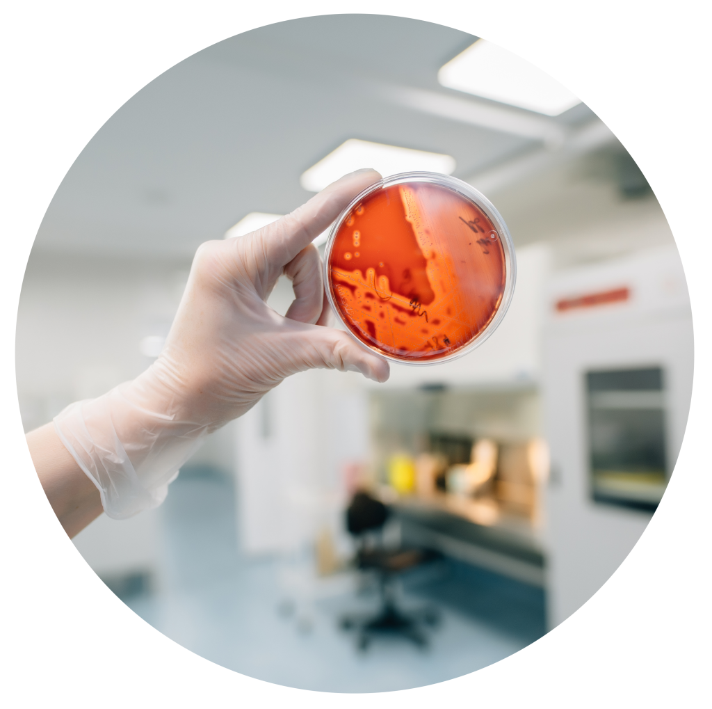 Аллергология 2 (астма).png